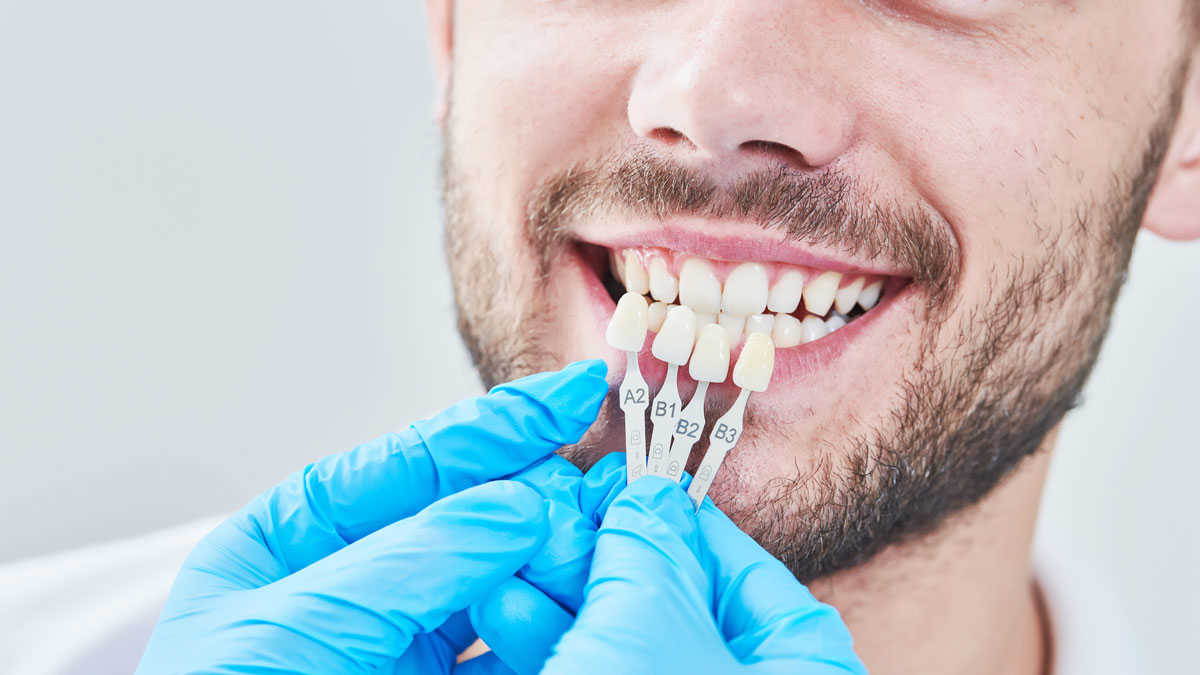 Реставрация зубов после лечения